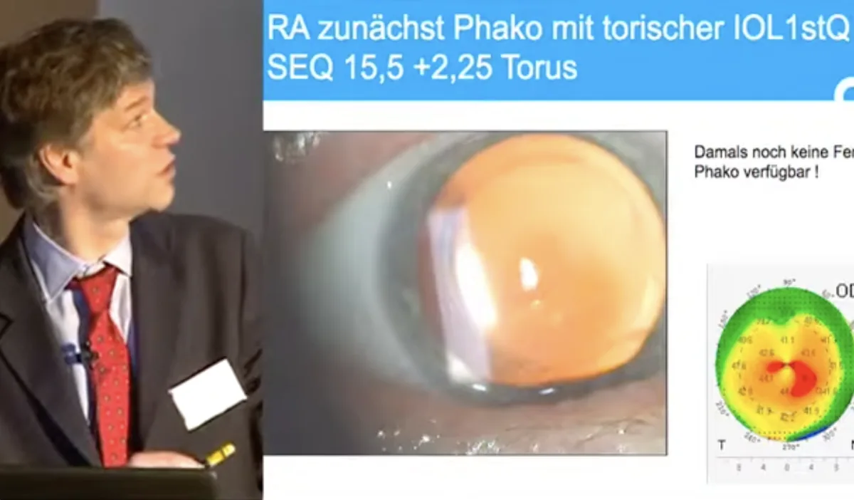 Dr. Gerten bei einem Fachvortrag auf einem ophthalmologischen Kongress